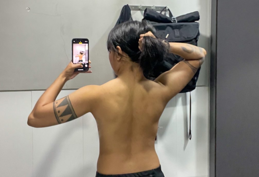 Photo of Sam showing her bare back